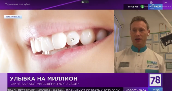 Какие бывают зубные украшения рассказывает доктор Сергей Лобанов в программе "Полезное утро"